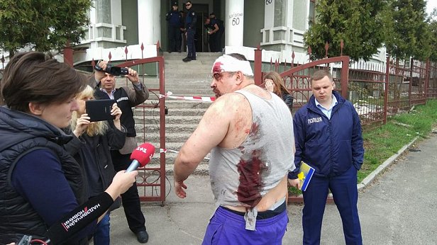 Брали штурмом: в Киеве “титушки” напали на дом, где живут переселенцы