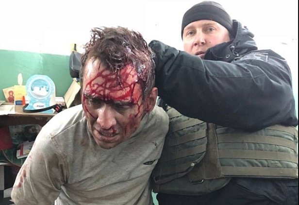 Аваков показал фото задержанного захватчика людей в “Укрпочте”